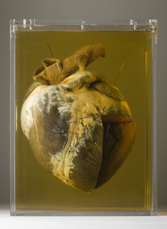 Phar Lap's preserved heart showing the shortened aorta, lack of pericardium and the section of ventricle wall removed for analysis. National Museum of Australia. Photograph by George Serras.